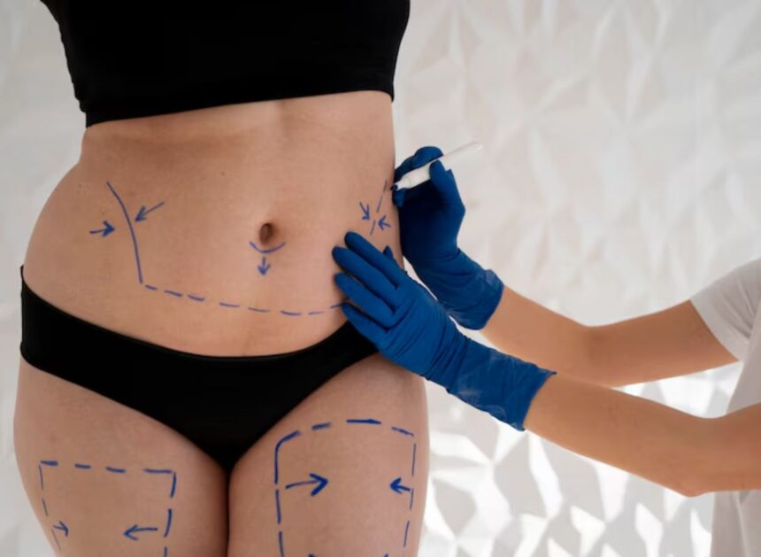 servicios de medicina estetica corporal en Quito