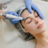 medicina estética facial en Quito